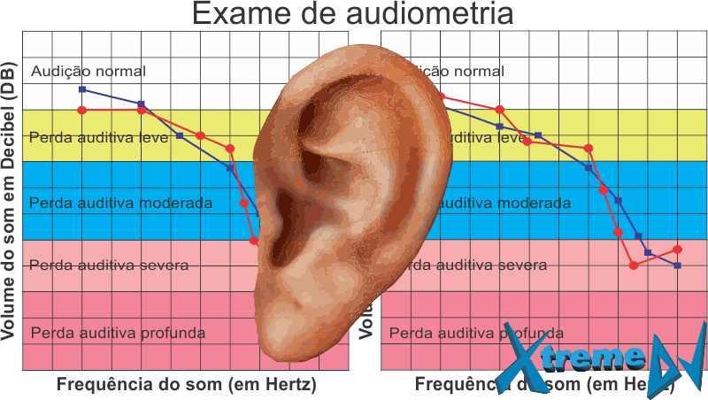 Os DJs e os exames auditivos (Audiometria) preventivos periódicos